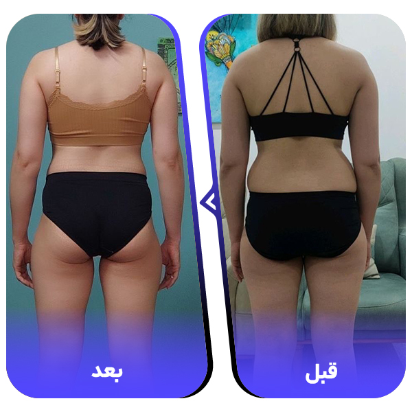 نتیجه قبل و بعد شماره 3