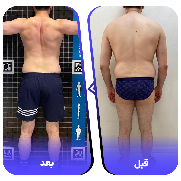 نتیجه قبل و بعد شماره 4